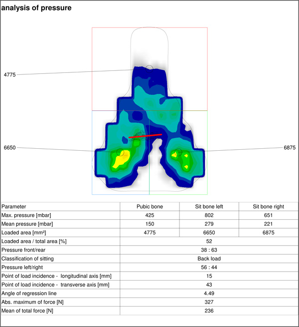 Saddle-Analysis 0